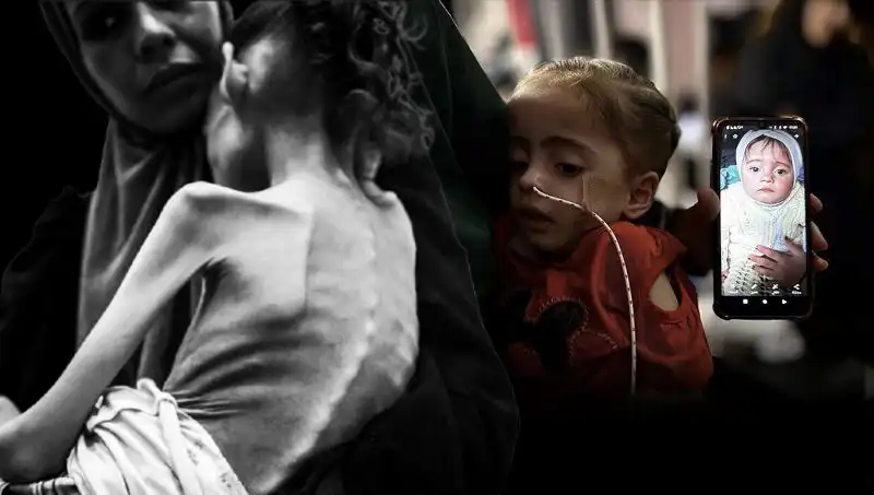 Küçük Meryem’in Açlıkla Mücadelesi: 10 Kilo ile Hayata Tutunuyor