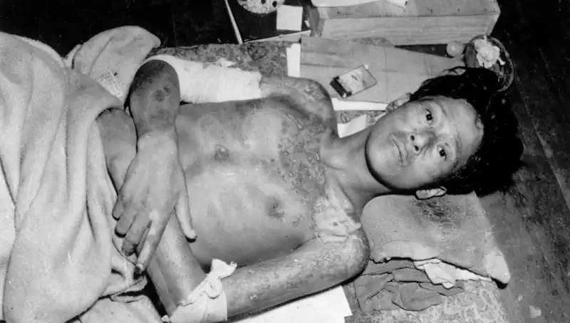 Nagasaki’den 80 Yıl Sonra Korkutan Uyarı: Nükleer Tehdit Göz Göre Göre Geliyor