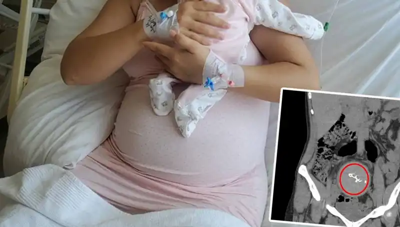 Sıra Dışı Olay: Doğumda Unutulan Bebek Gazlı Bezle Ortaya Çıktı